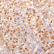 Staining with mouse monoclonal ACTH [Clone 2F6] antibody in formalin-fixed paraffin-embedded human pituitary gland.